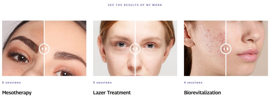 Healthcare website showing laser treatment service page